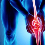 osteoarthritic_pain_1200x